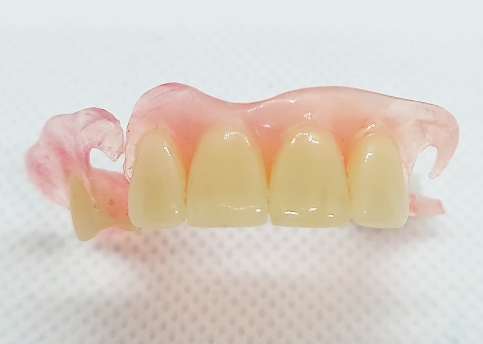 Flexible Partial Dentures – Dental Lab Direct