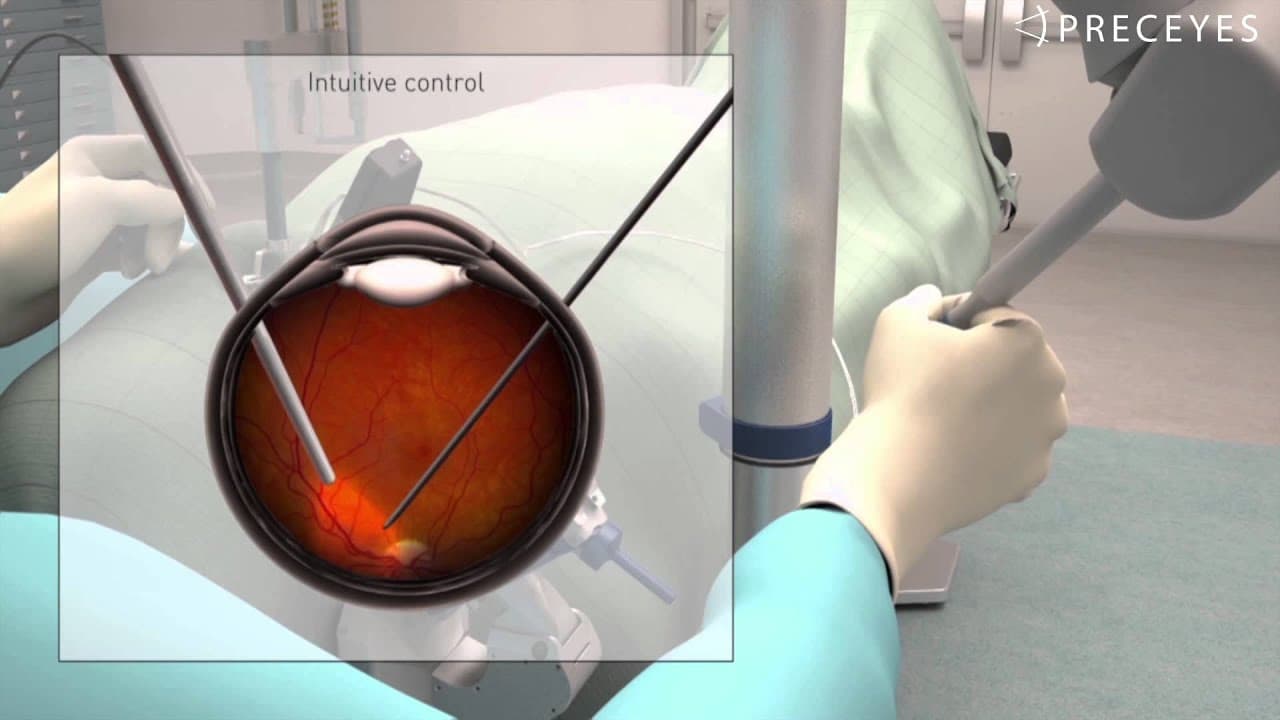 PRECEYES Surgical System - YouTube