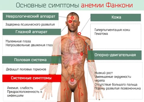 Na kakšne bolezni so anemijo. Resnost anemije na ravni hemoglobina ...