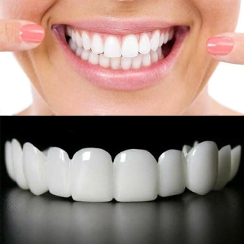 Snap-On Smile by DenMat