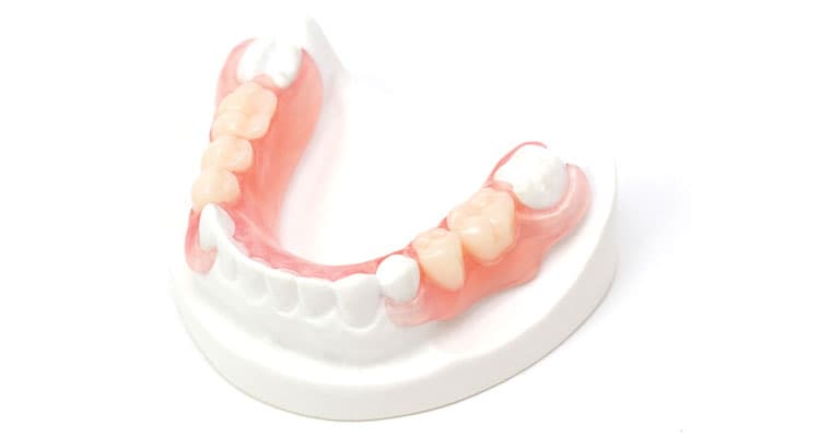 SunFlex® Partials – Sun Dental Labs