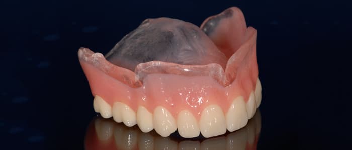 Dental Labs for Dentures in Arizona - Conventional Full and Partial ...