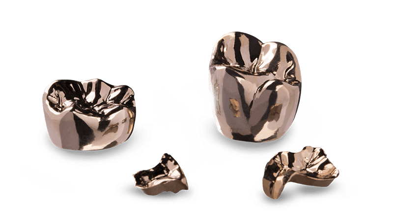 Full-Cast Gold Crowns - Full-Cast Restorations - Glidewell