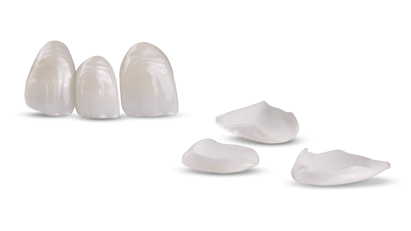 Veneers provide beautiful solutions for patients!