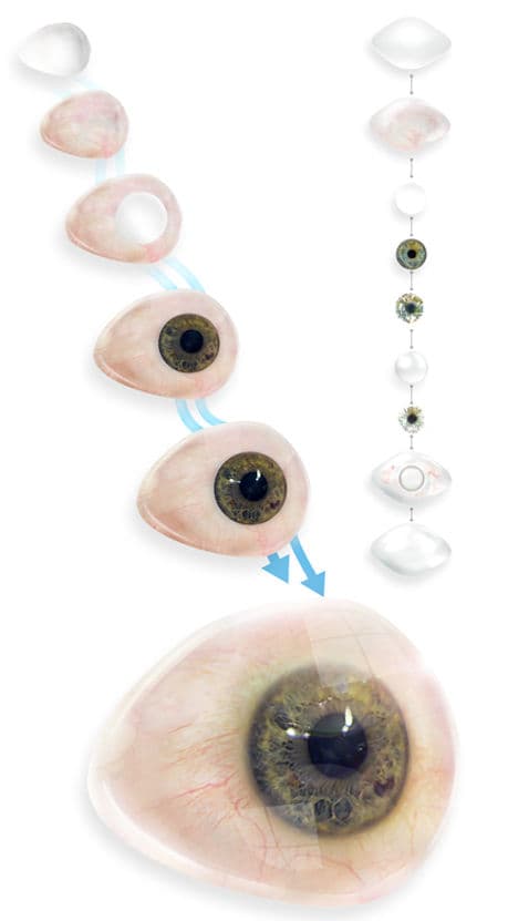 Eye | Reallifefaces Alloplastic Reconstruction Artificial Eye Clinic
