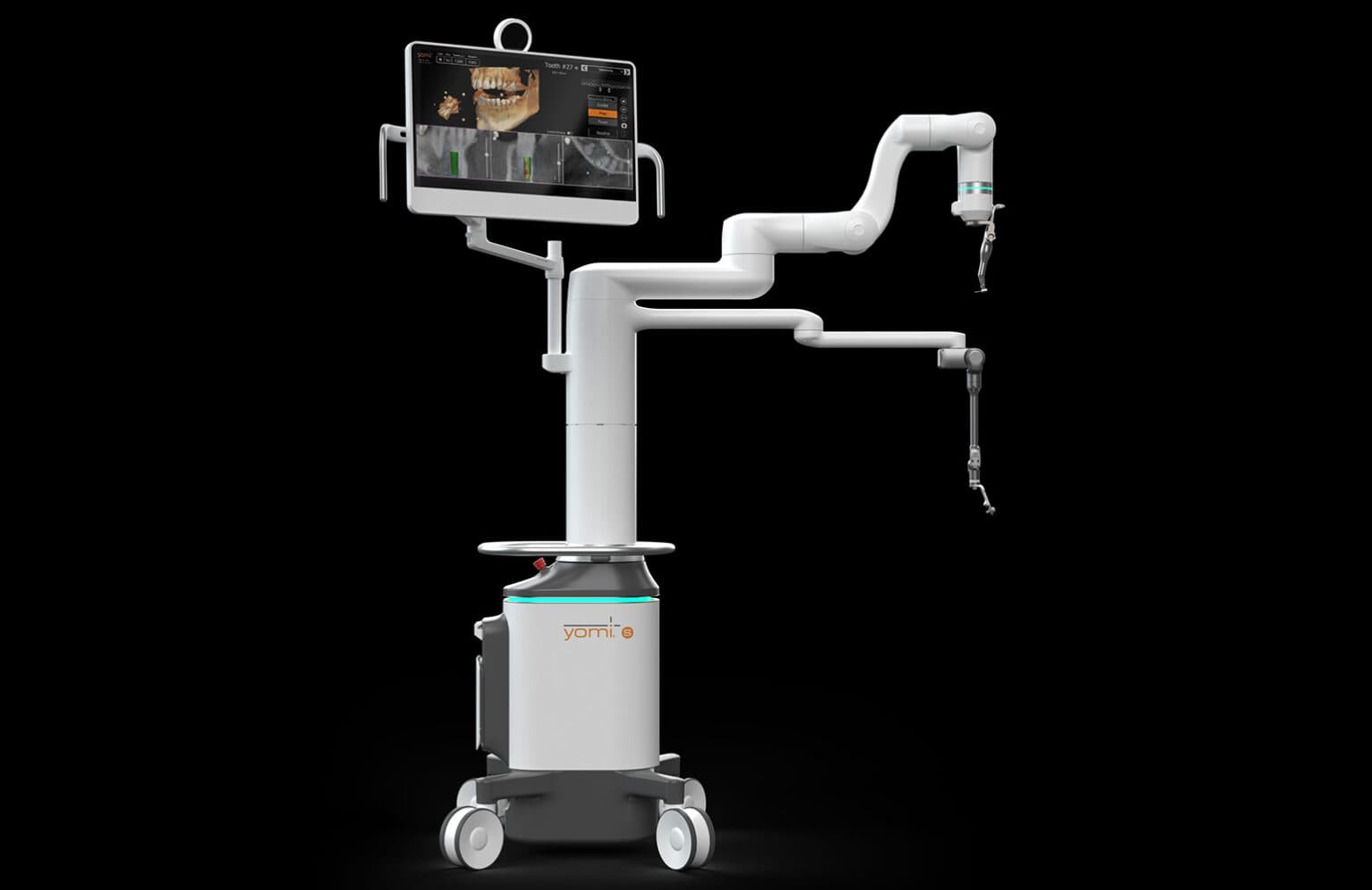 Neocis unveils upgraded Yomi S robotic system for dental implants - The ...